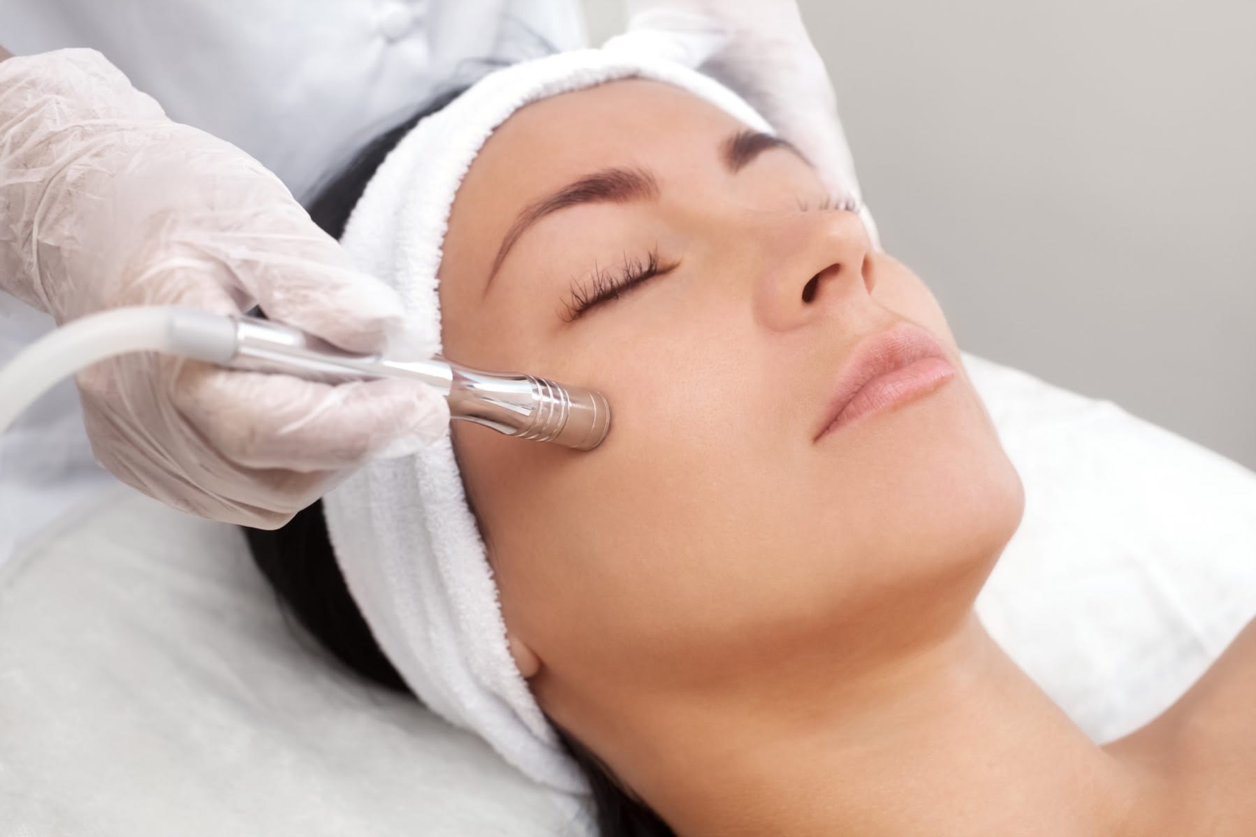 Diamond Dermabrasion Charlotte